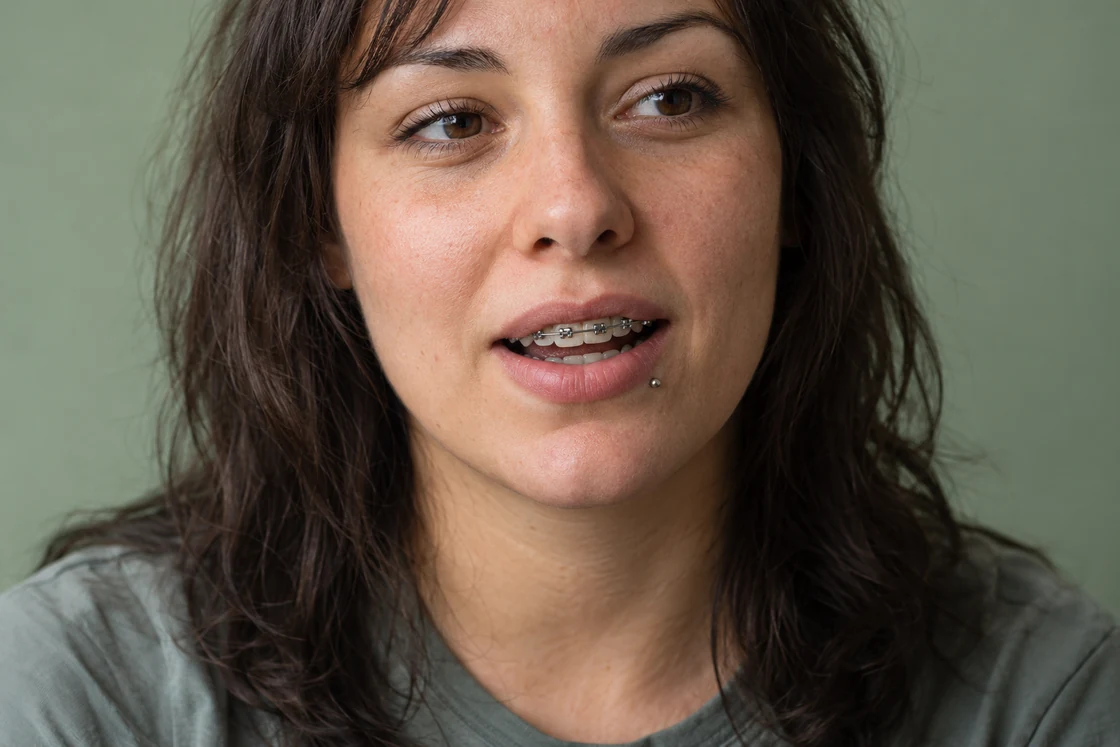 An adult with braces and a small lower-lip stud.