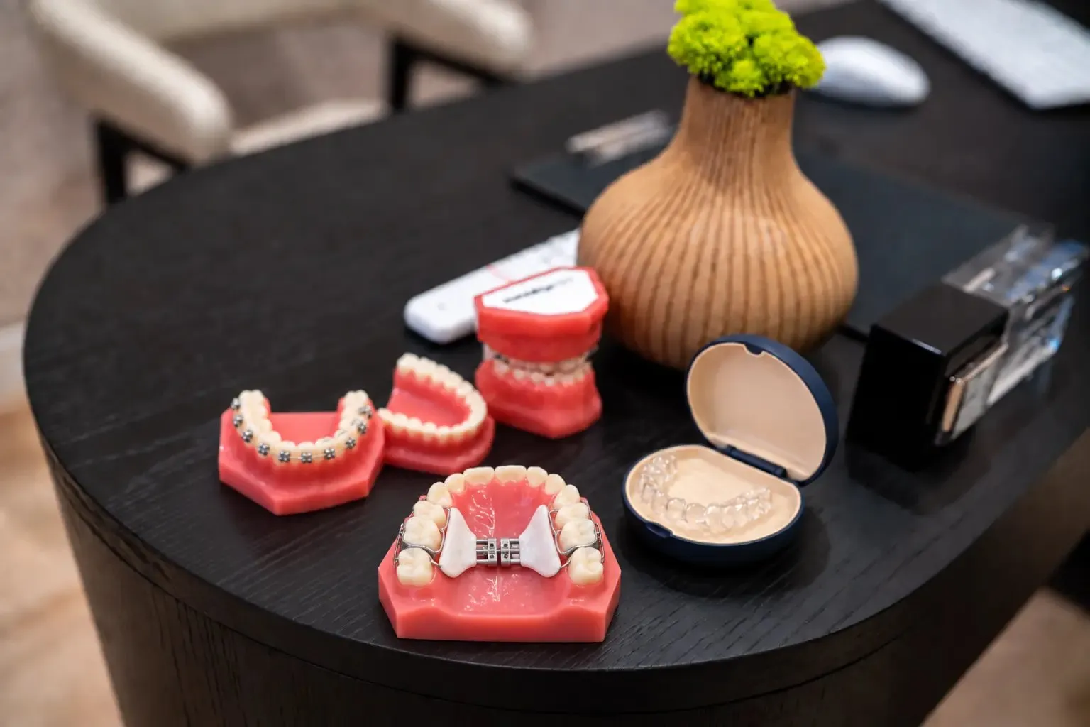 A palatal expander model on the consultation table at SC Orthodontics