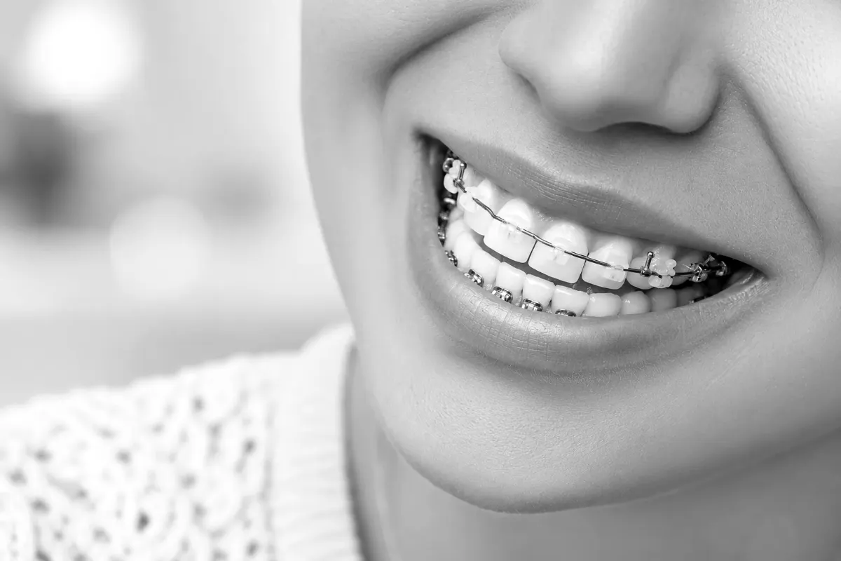 A smiling teen with braces